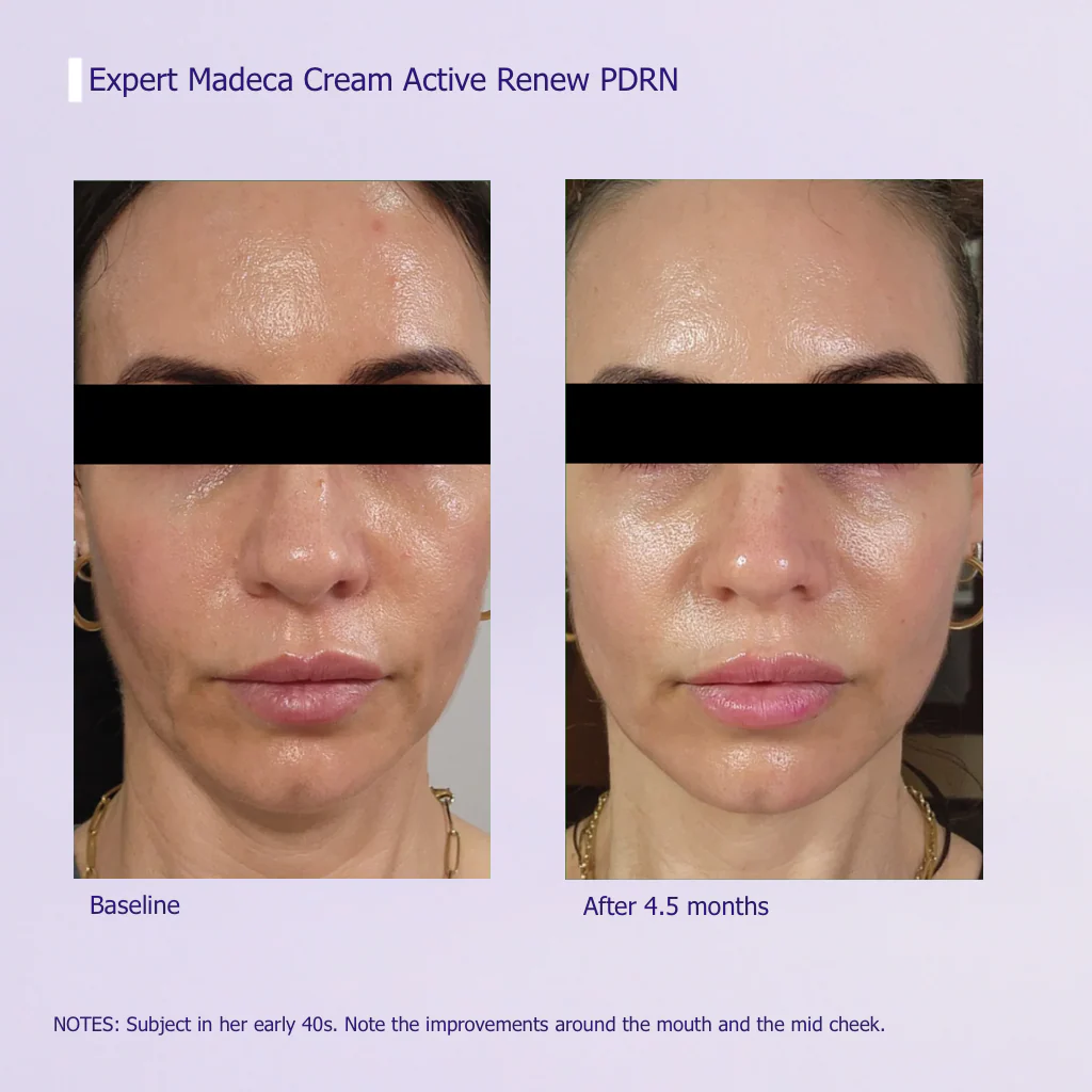 ELEVARE PDRN Active Renew Cream – NEW YEAR OFFER - Image 9